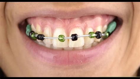 how to make fake braces with bobby pins|how to make real braces.